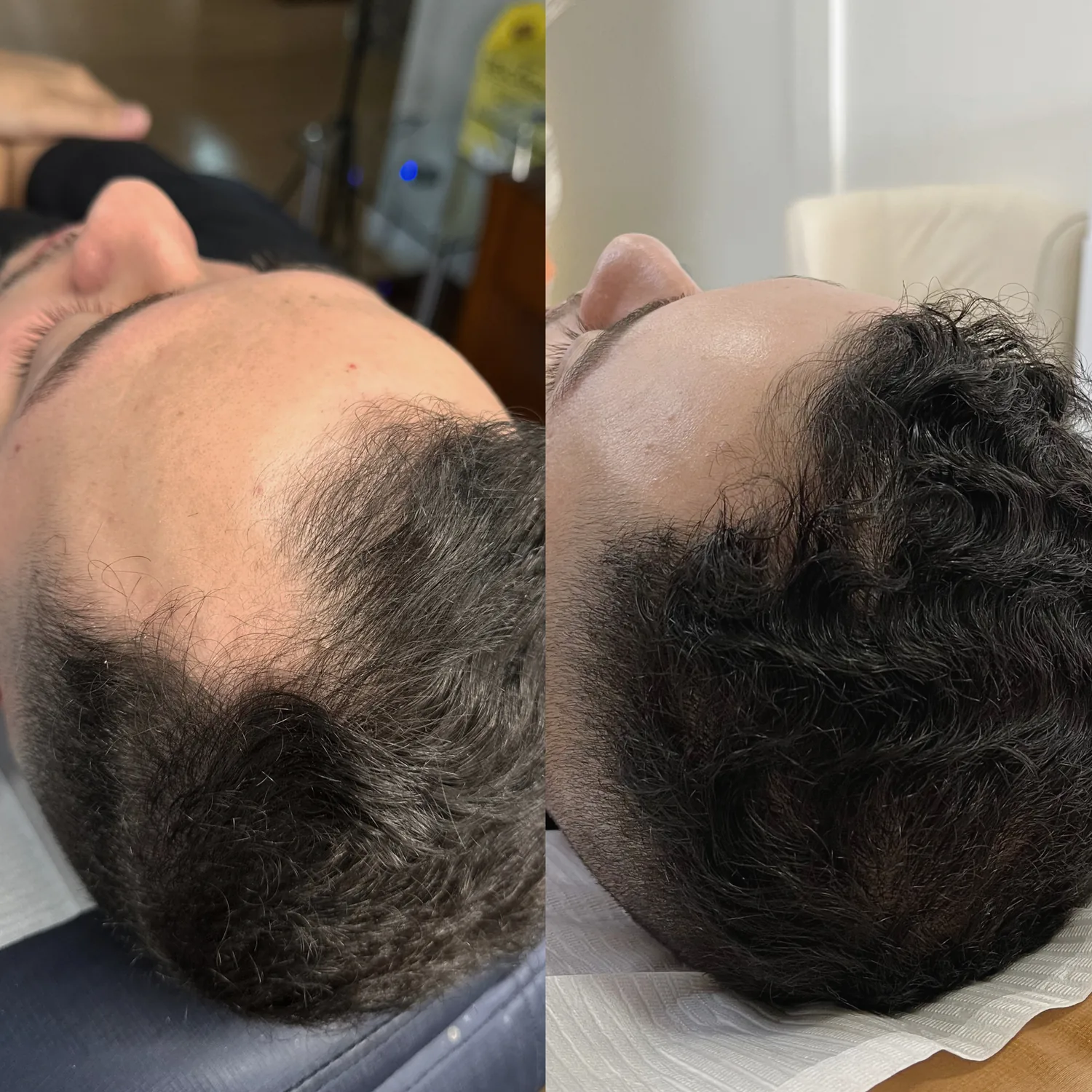 Fotos de antes e depois 1