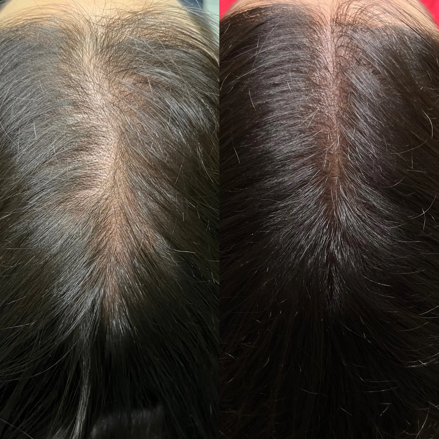 Fotos de antes e depois 2