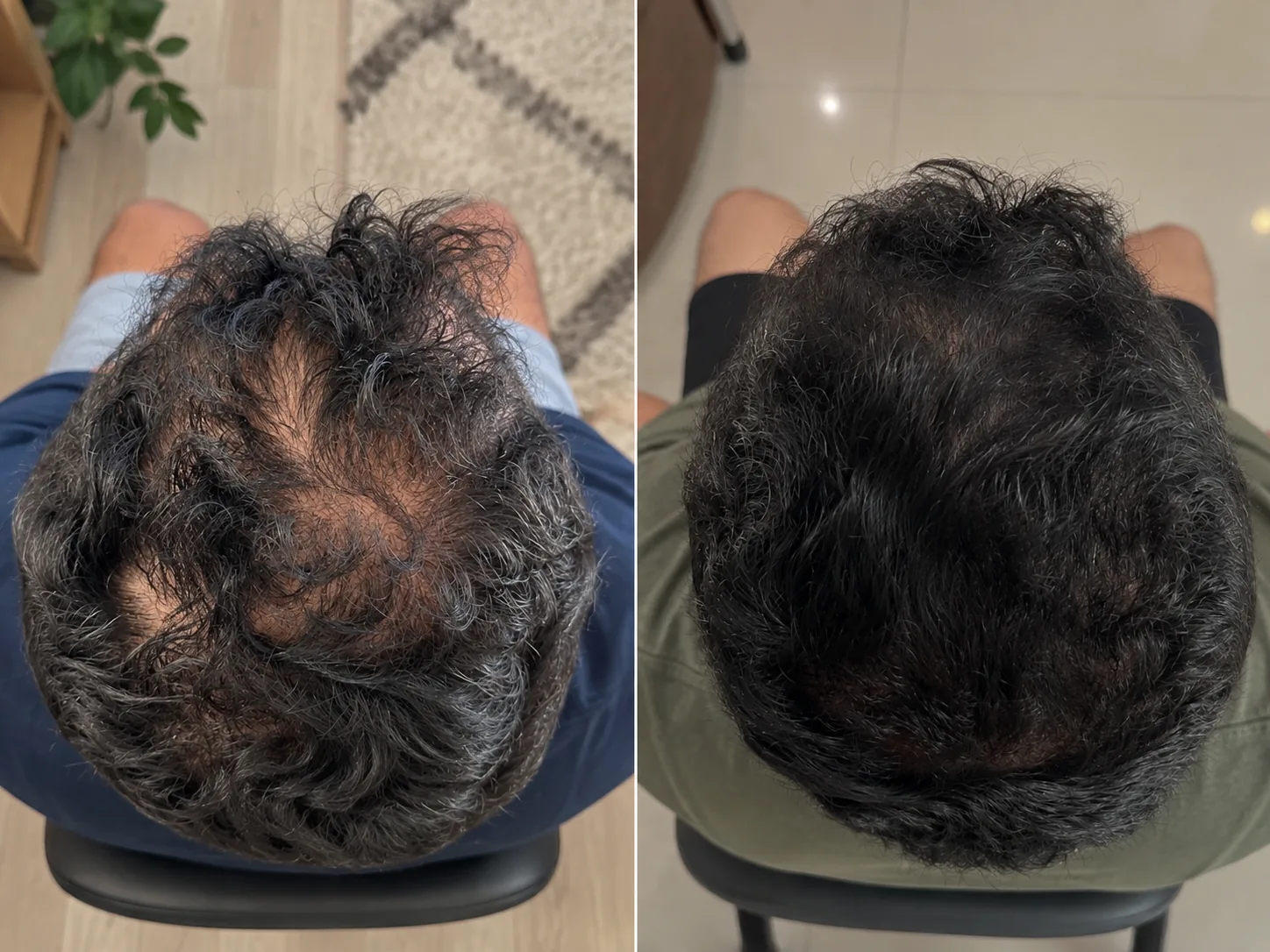Fotos de antes e depois 3
