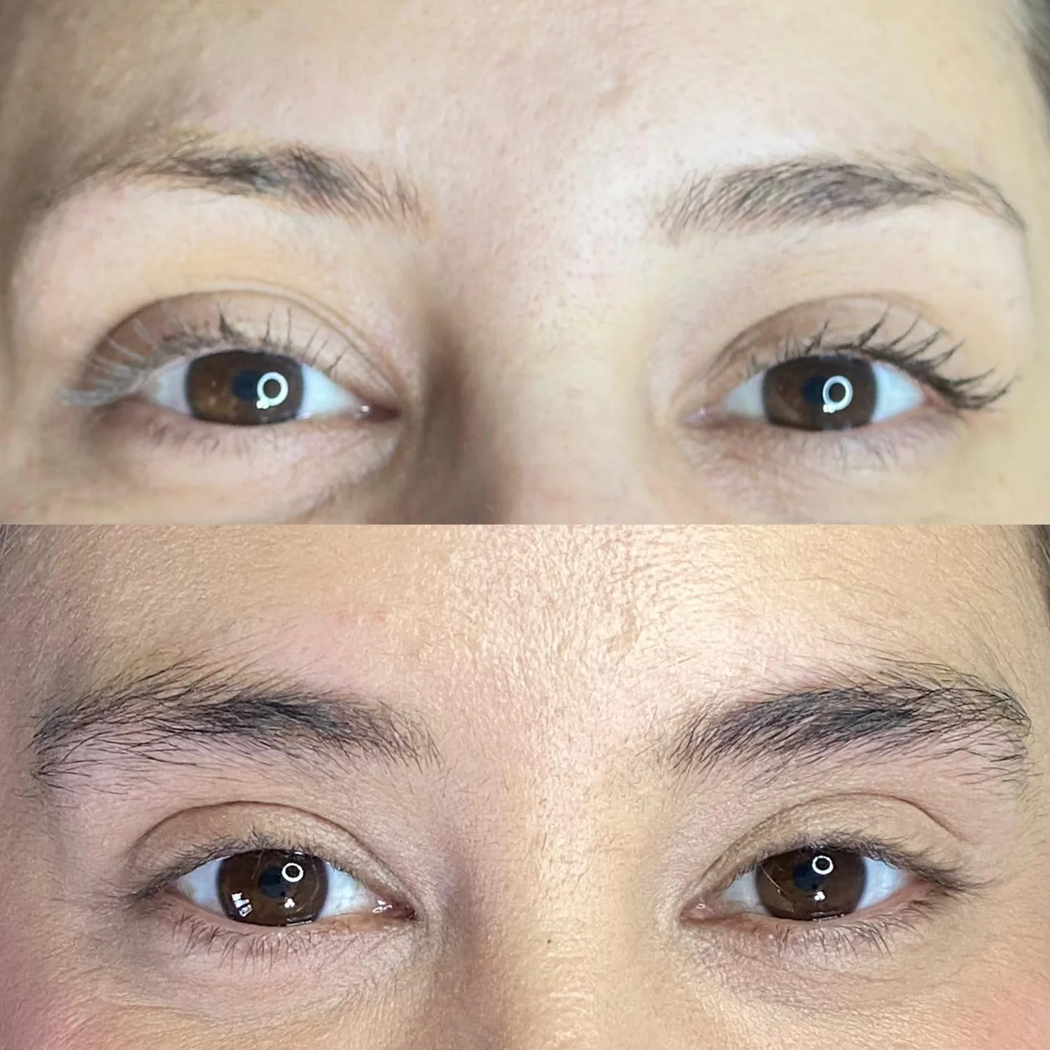 Fotos de antes e depois 1