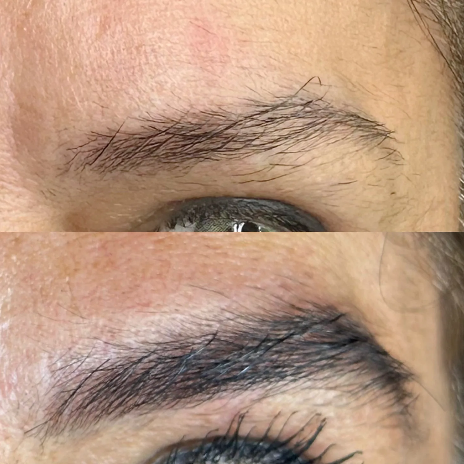 Fotos de antes e depois 2