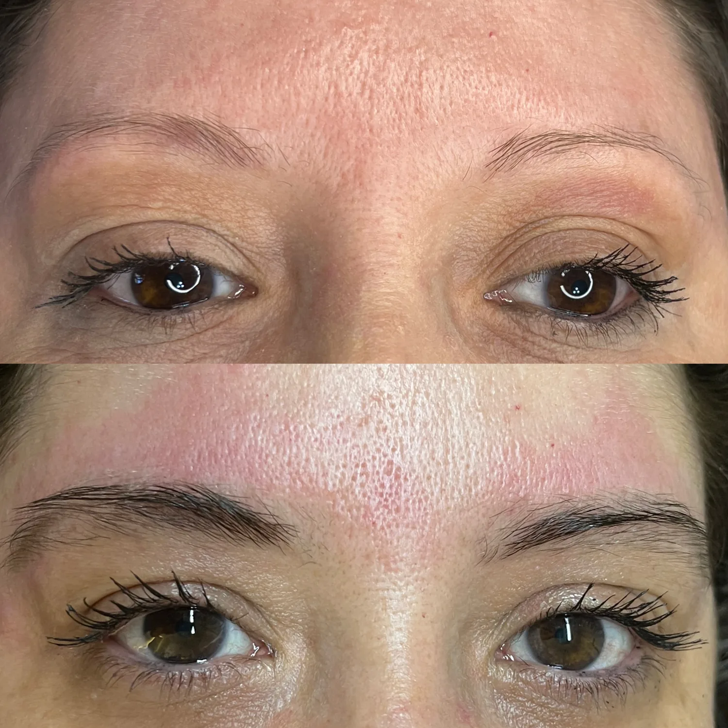 Fotos de antes e depois 3