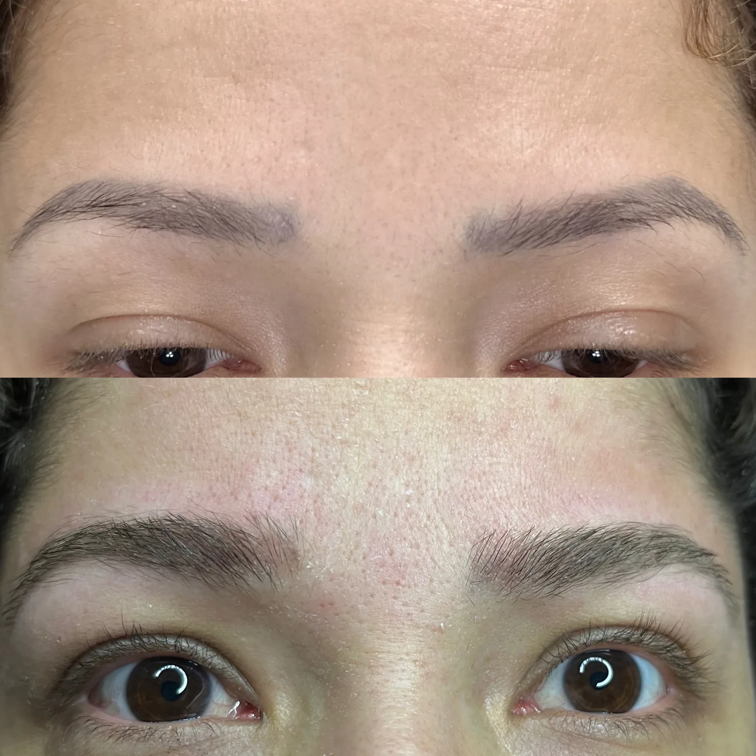 Fotos de antes e depois 4