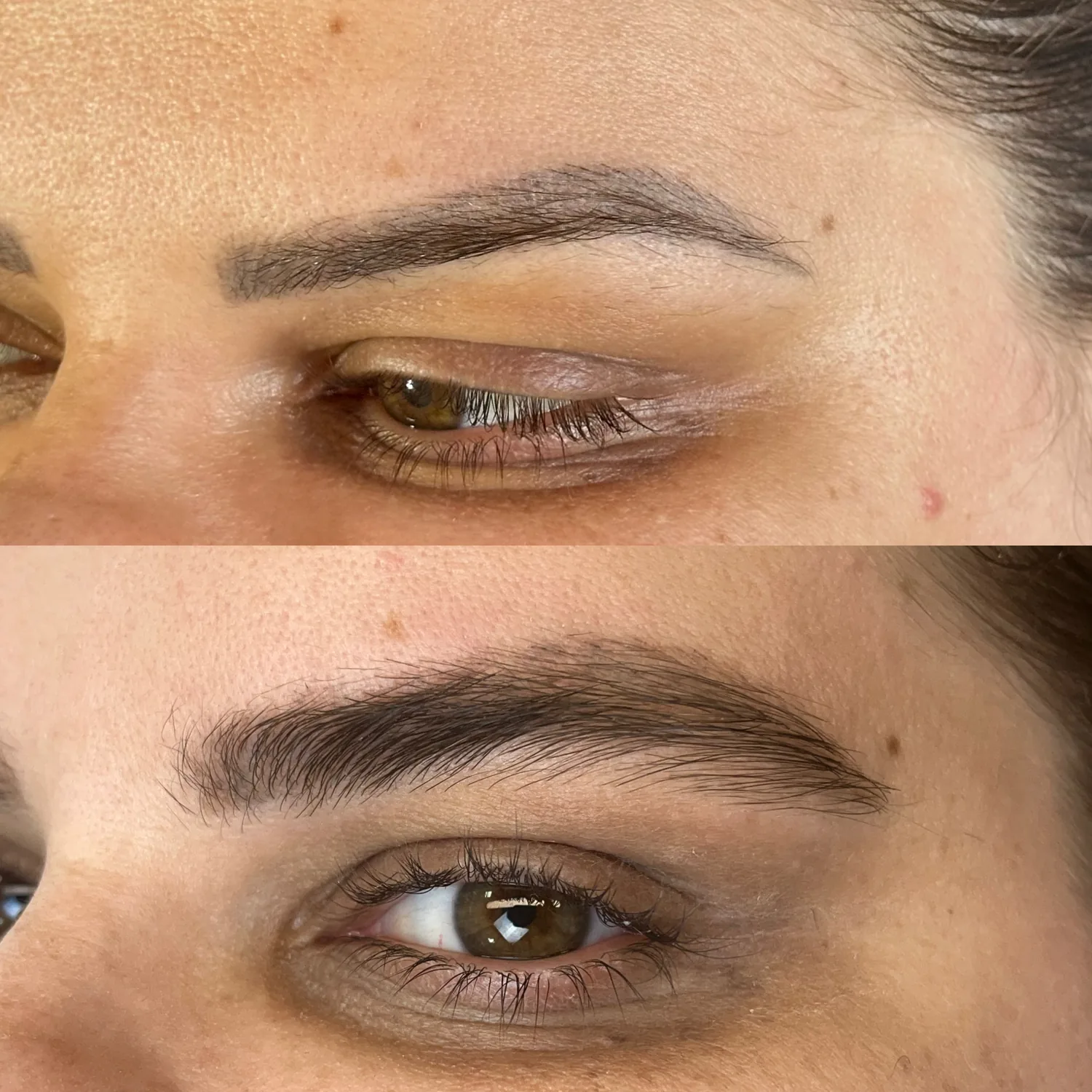 Fotos de antes e depois 5