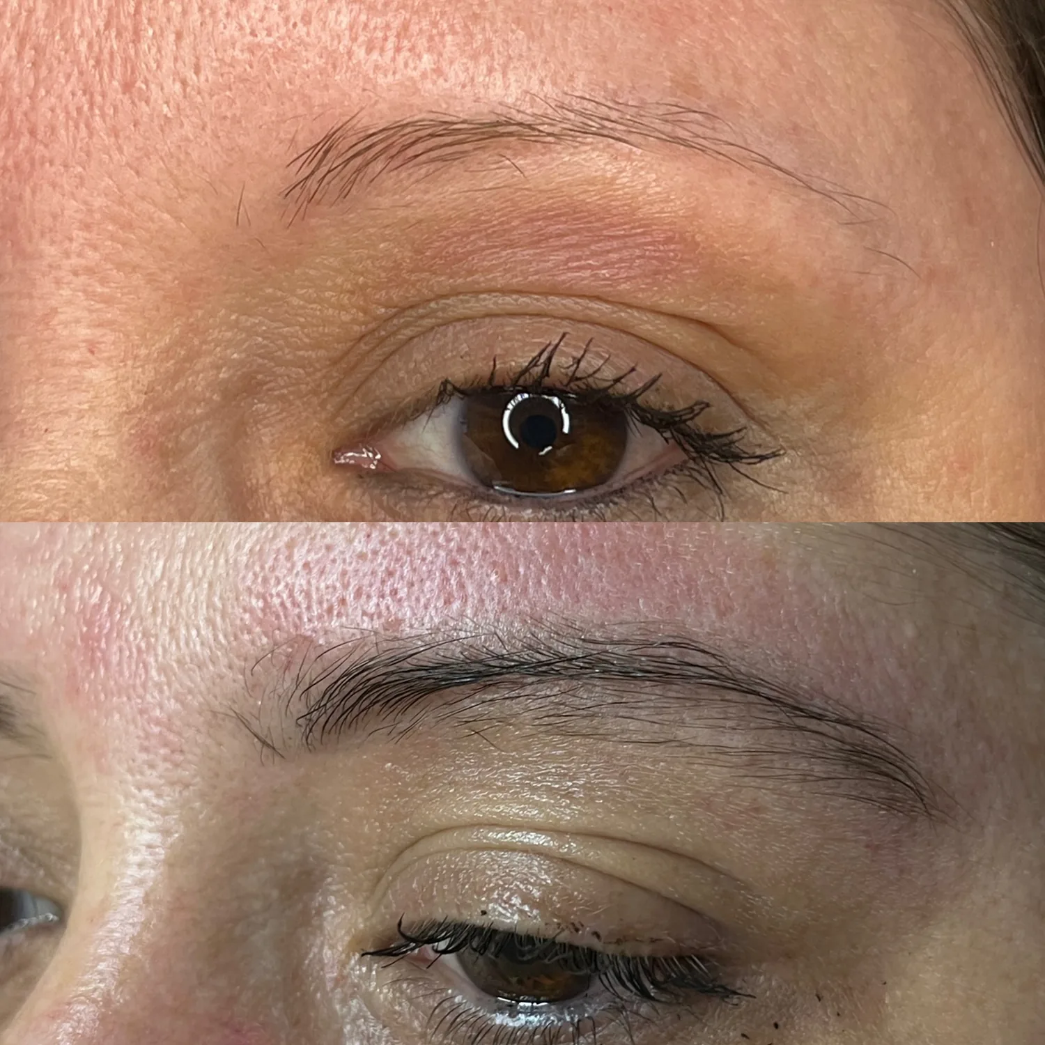 Fotos de antes e depois 6