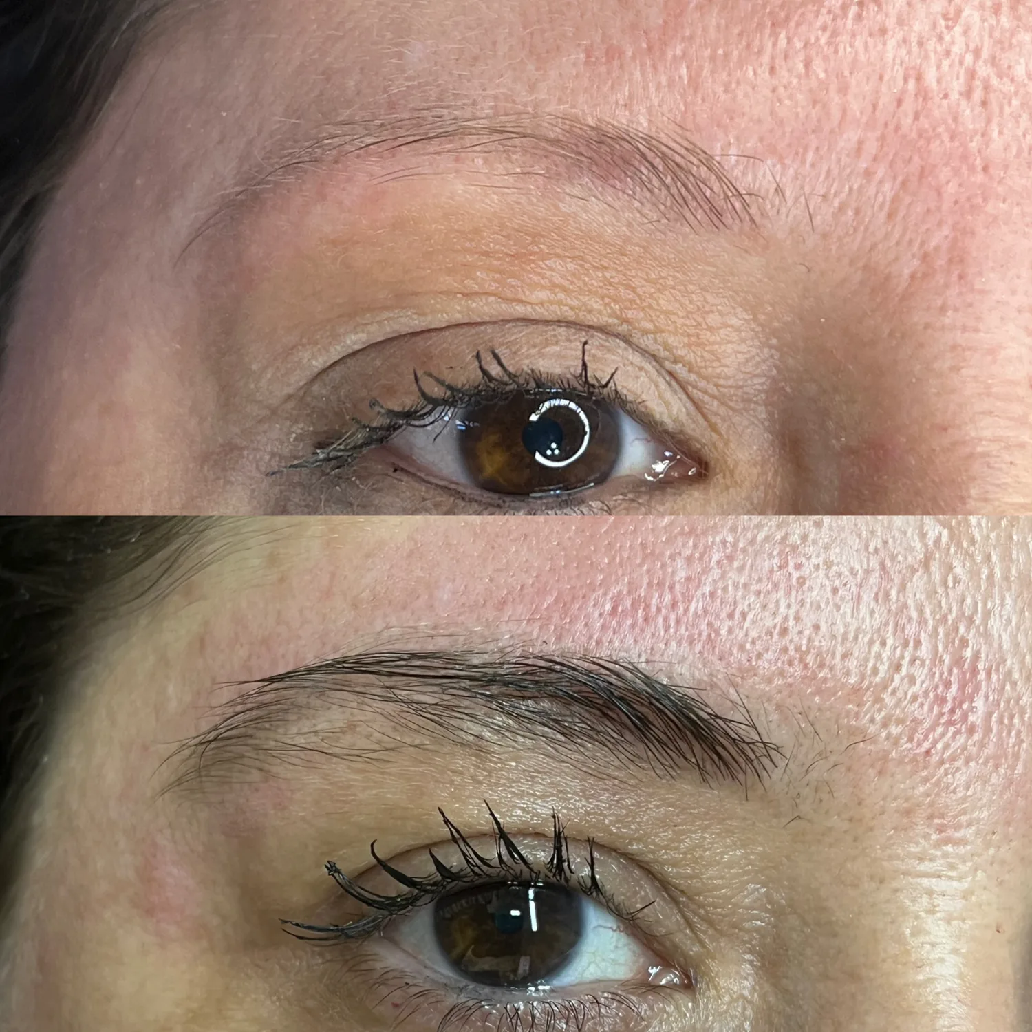 Fotos de antes e depois 7